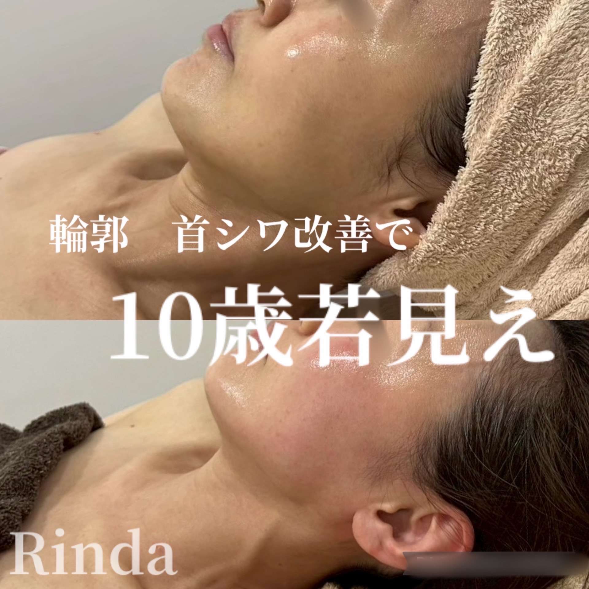 アレックス　プラズマ高周波美顔器　ほうれい線、シワ、たるみ、ニキビ＆跡の改善 20250724074601.jpg