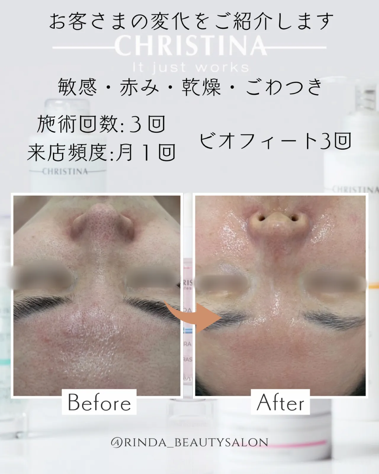 最短3ヶ月〜敏感、乾燥、赤み、毛穴ひらきなど肌質改善したい方はクリスティーナがオススメ！兵庫県（尼崎エステ）Rinda Beauty Salonリンダビューティーサロンへ