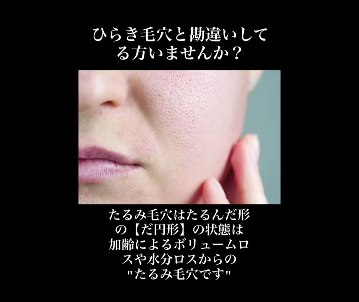 40代、50代の毛穴たるみのお悩みは兵庫県（尼崎エステ）Rimda Beauty Salonリンダビューティーサロンで根本改善しませんか？