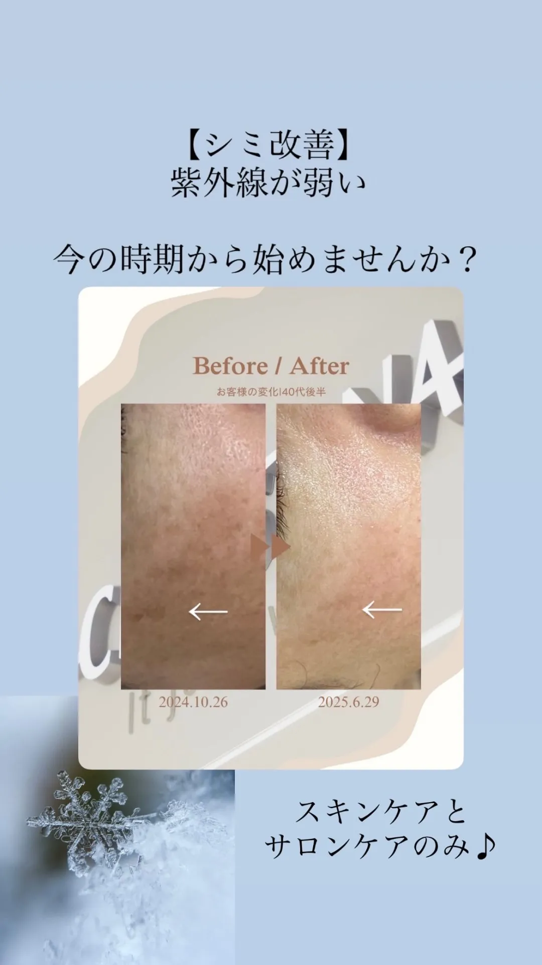 急に出てきたシミは放置してたら危険！改善は【尼崎フェイシャル/肌質改善サロンRindaリンダ】へ！