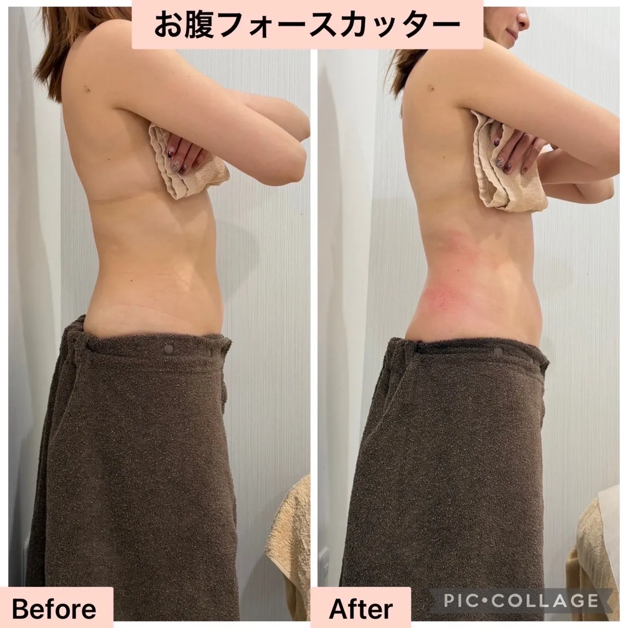 冬のぽっこりお腹改善！は兵庫県（尼崎エステ）Rinda Beauty Salonリンダビューティーサロン