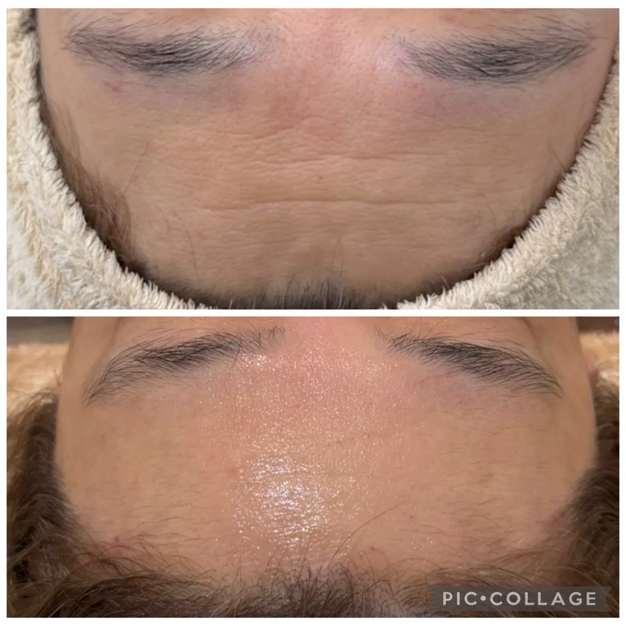 【尼崎肌質改善フェイシャルエステサロン】くすみ・小じわ・頬がこけてきた…50代から増える肌悩みの原因と改善方法