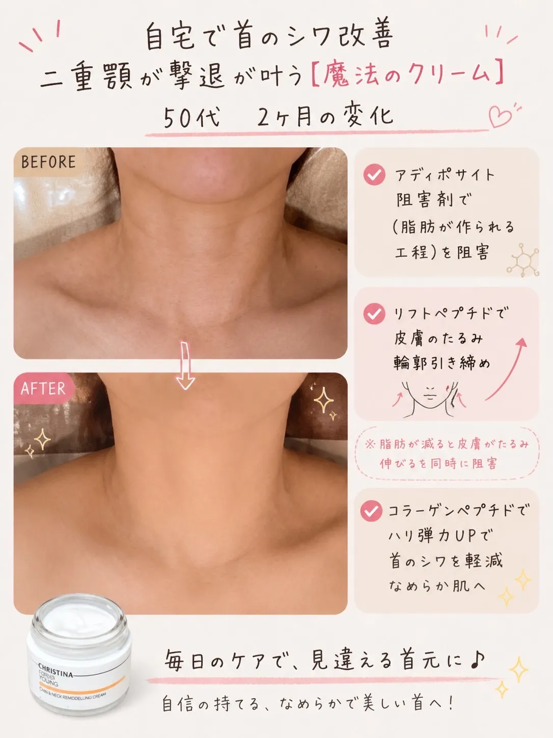 【JR尼崎・首のシワ改善】50代・2ヶ月の変化｜二重顎・首のシワを諦めない「サロン×ホームケア」