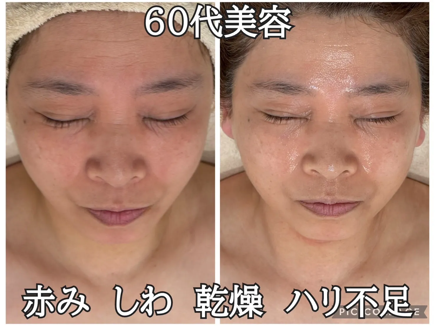 JR尼崎駅前エステ【60代の肌改善】赤み・しわ・乾燥…年齢肌の4大悩みを解決してハリツヤ肌に導く方法