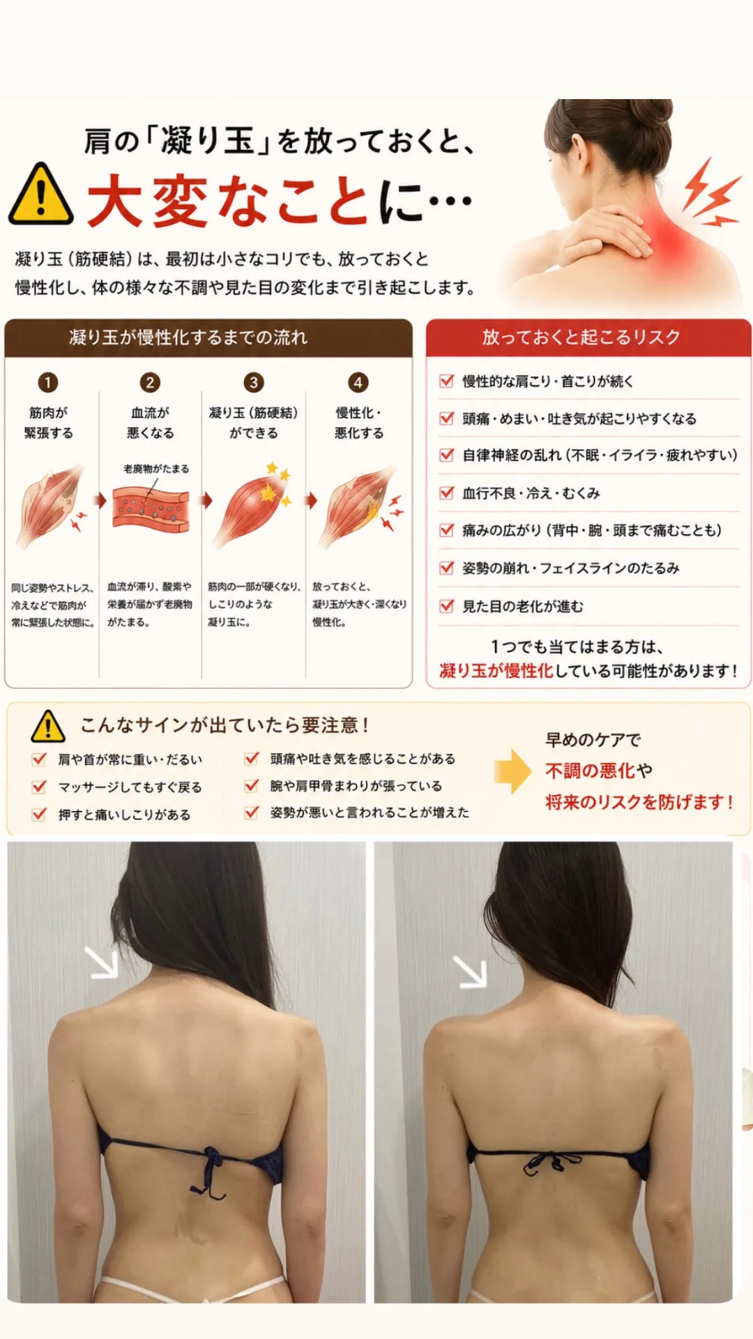 JR尼崎駅/結婚式前に後悔しないために｜ブライダルエステは「首・肩・背中」まで整えることが大切